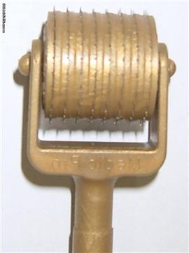 Efficacy of microneedle--- ZGTS