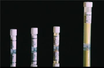 What did ADA (adenosine deaminase) do that you don't know?