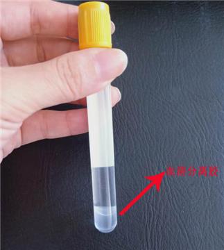 Classification of vacuum blood collection tubes, principle and function of additives