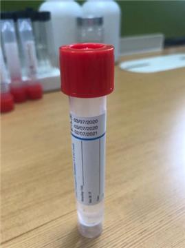 The protector of the disposable virus preservation tube in the epidemic