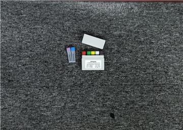 Sex-Determining Region on Y Chromosome Probe PCR Kit